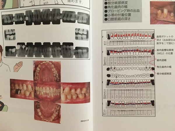 歯周病の講習セミナー参加　1回目