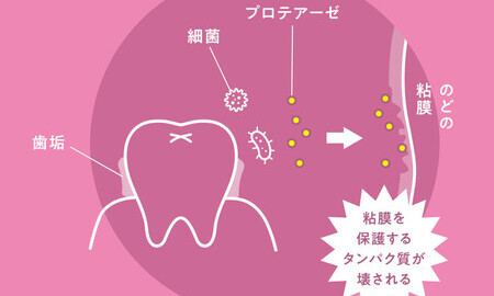 今だからウイルス対策「歯垢の除去で、 ウイルス感染を減らそう! 」