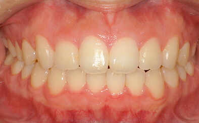 After image