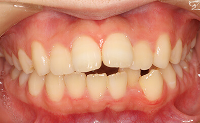 Before image