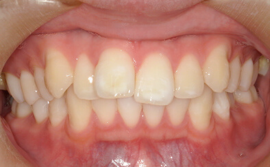 Before image