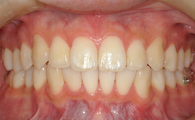After image