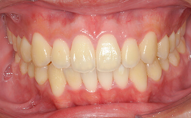 After image
