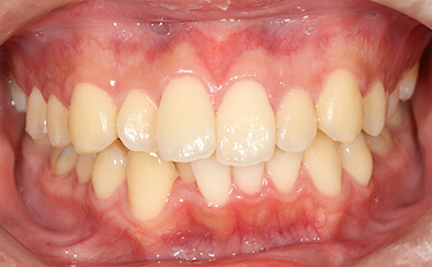 Before image
